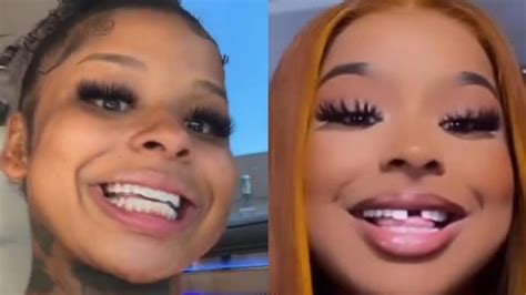 how did chrisean rock lose her tooth|Chrisean Rock Replaces Her Missing Tooth Then。